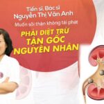 Lợi Ích Khi Sử Dụng Đả Thạch Vương Điều Trị Sỏi Thận